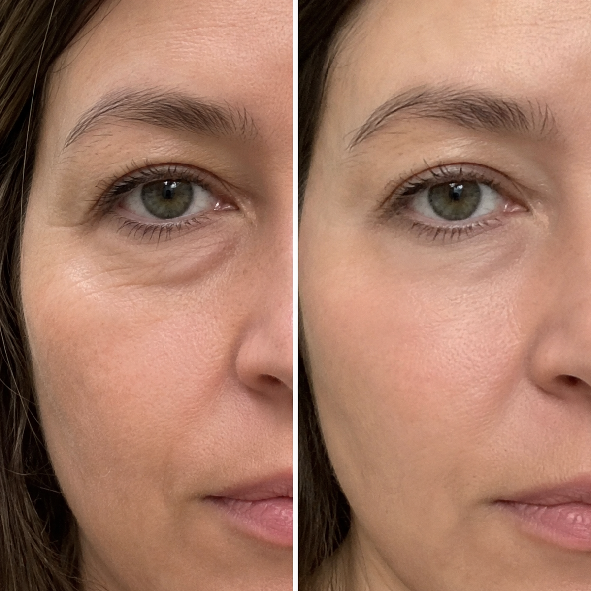 PRACTS Collagen Renewal Set - Eye Care Edition-DE