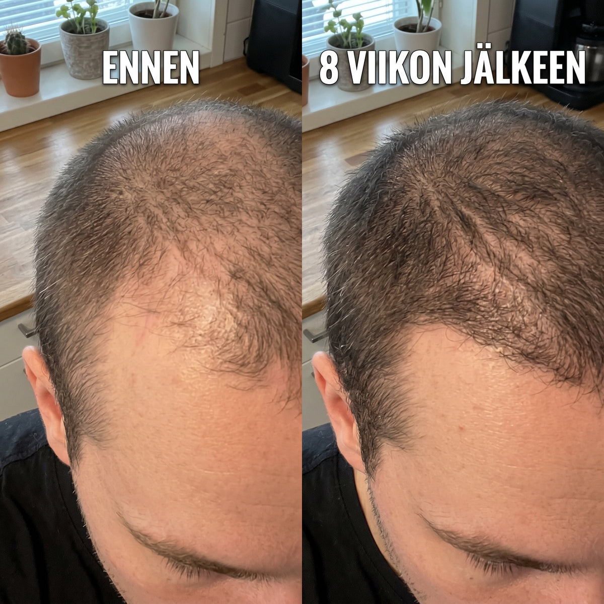 PRACTS Kurpitsansiemenöljy Pehmytkapselit